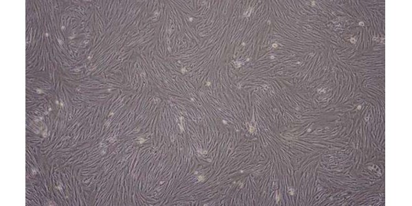骨髓间充质干细胞如何采集、分离与保存