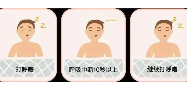 你真的了解睡眠呼吸暂停吗？6600万中重度患者正在受害！—仟龙医疗