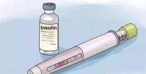 注射胰岛素部位有哪些讲究