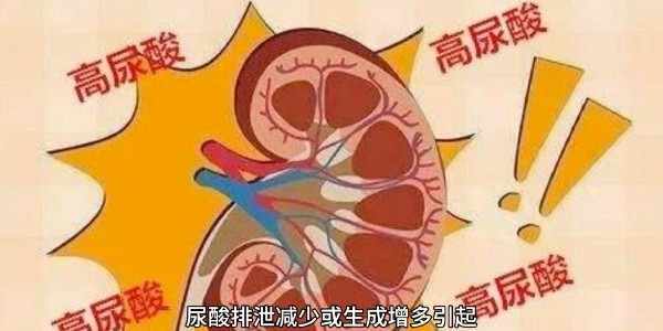突然痛风？别再只怪啤酒和烧烤！真正的“尿酸元凶”远比你想的多！
