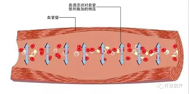 高血压的形成