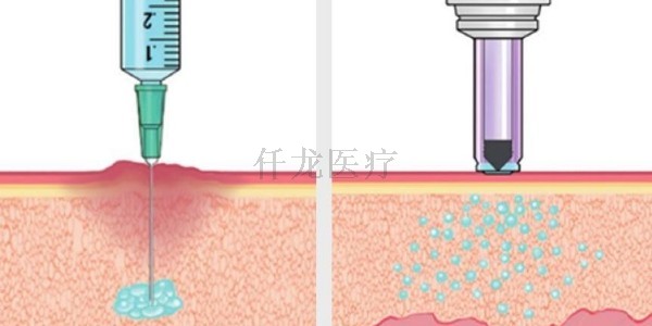 无针注射器让糖尿病患者免受扎针痛苦